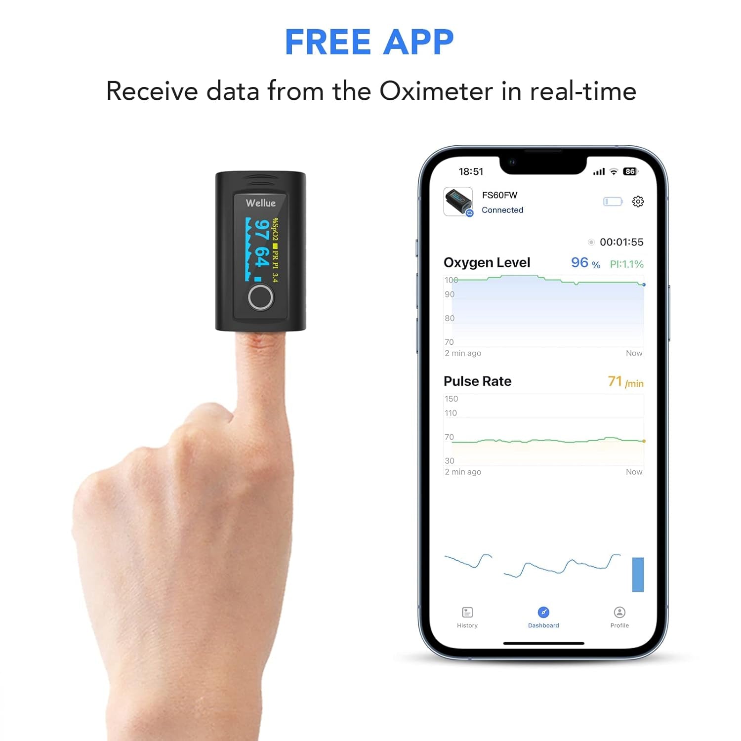 Bluetooth Pulse Oximeter Approved UK Built-In Offline Storage, Oxygen Monitor Finger Adults for Heart Rate Blood Oxygen Saturation Includes Carrycase and Lanyard, Free APP